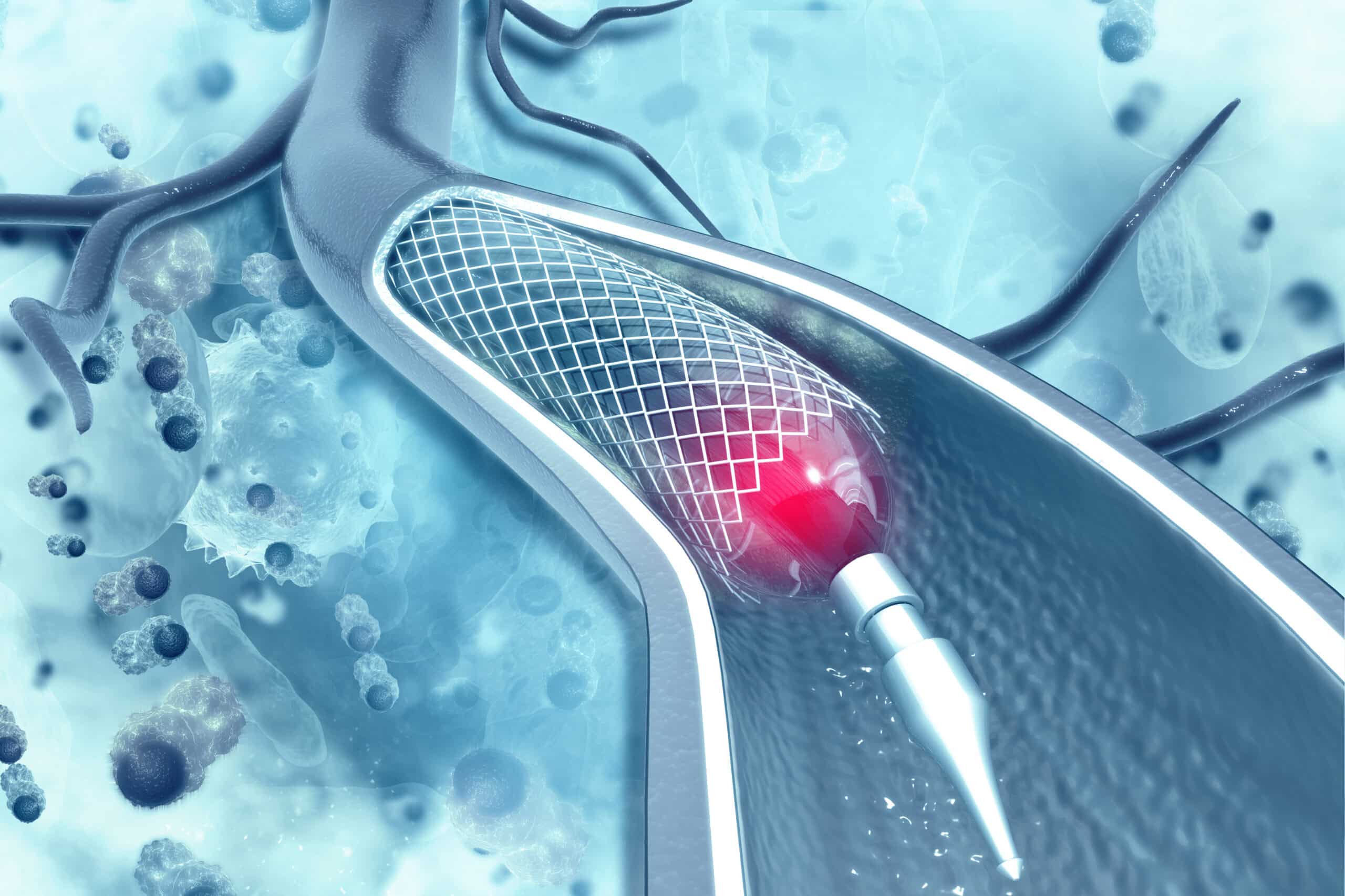 Medical stent on scientific background